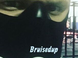 Bruisedup